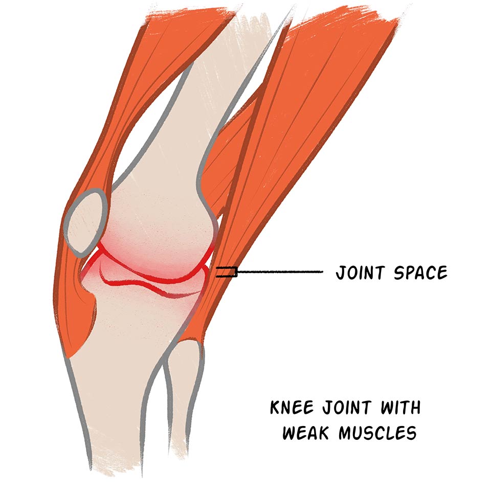 weak-muscles-compressed.jpg